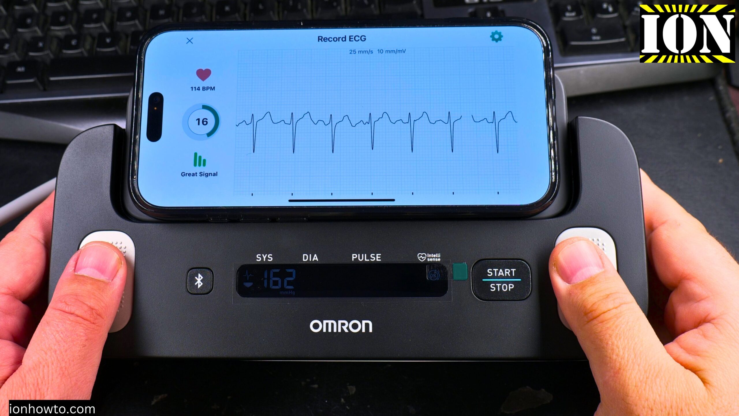 OMRON Complete ECG Blood Pressure Reading App
